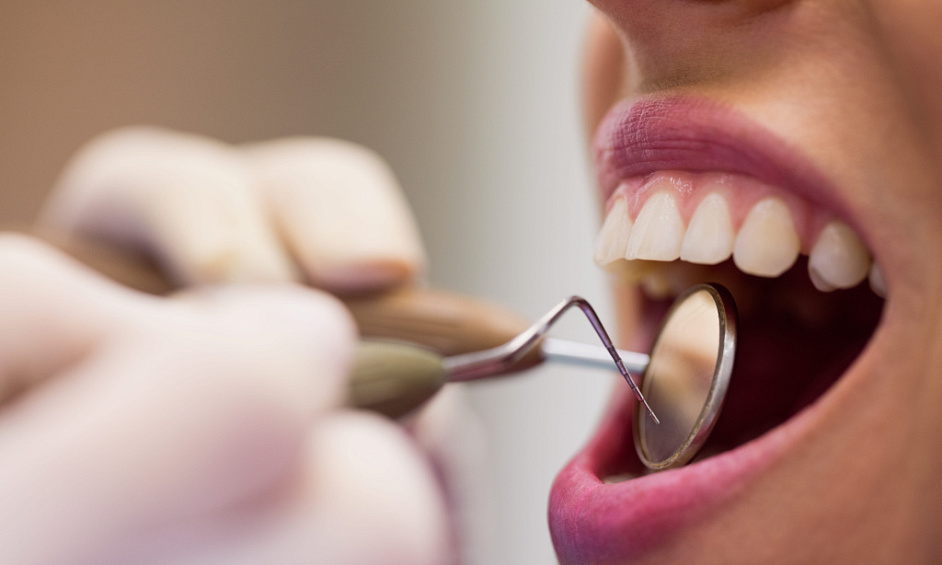 Business For Sale -teeth Whitening 1